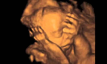 <span class="bulten-baslik-etiket">/ Tezler /</span> Ultrason Fetus İmajı: Doğum Olayı, Kadın Bedeni ve Tıbbi Söylem